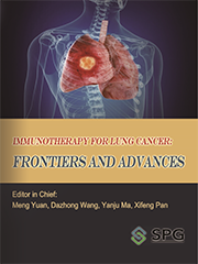 Immunotherapy for Lung Cancer: Frontiers and Advances | Scholar Publishing Group